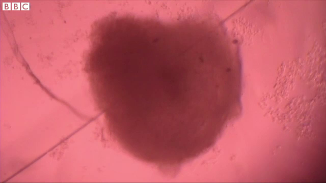 Curand, oamenii nu vor mai fi "cobai". Inimi de 1 milimetru fiecare, create in laborator pentru studii