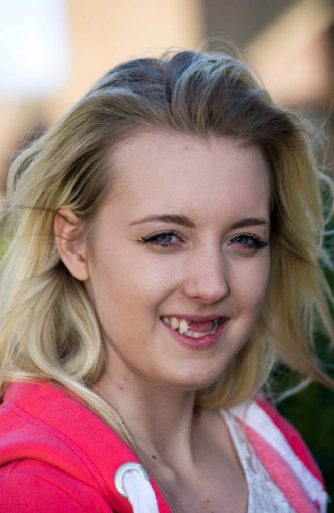 Luni de zile nu a mai zambit din cauza accidentului care i-a distrus dantura. Cum s-a transformat dupa un implant dentar