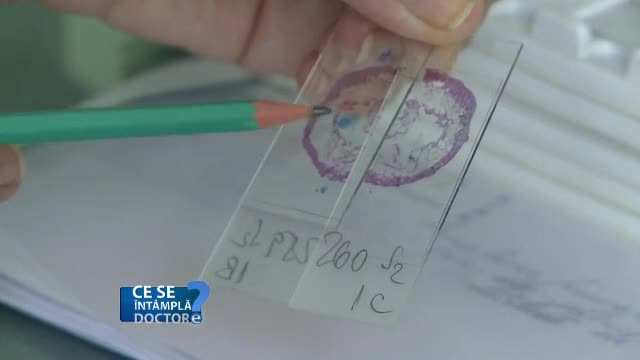 Cand e bine sa facem teste pentru hepatita B si C, pentru a depista boala din timp