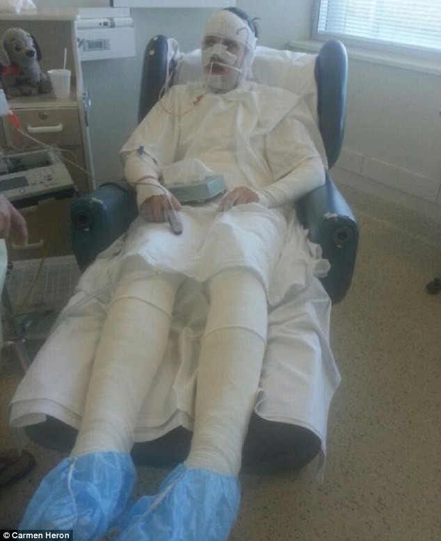 Reactia alergica la un medicament a transformat-o intr-o mumie. Cum arata tanara de 19 ani inainte de boala