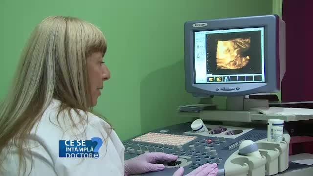 Care este cea mai frecventa tumora benigna in randul femeilor si ce trebuie sa faceti pentru a o diagnostica