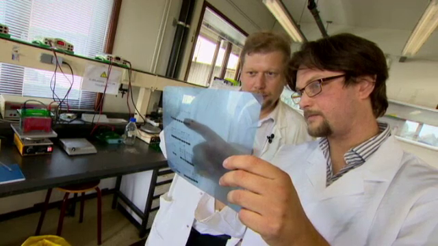 A lucrat 6 luni in Africa, iar cand s-a intors a aflat ca in tot acest timp 20 de viermi traiau sub pielea lui. VIDEO