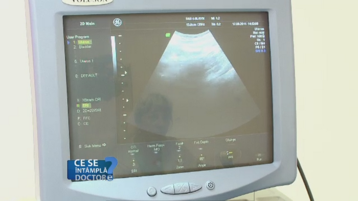 Menstruatiile care dureaza prea mult pot ascunde probleme grave de sanatate. Care este sfatul medicilor