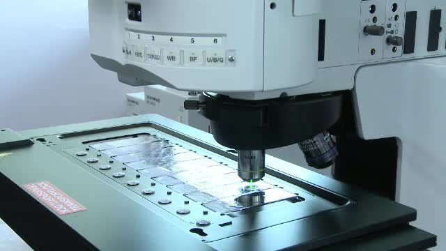 Treaba facuta pe jumatate. Statul investeste in tratamente pentru bolnavii de leucemie, dar nu si in analize de diagnosticare