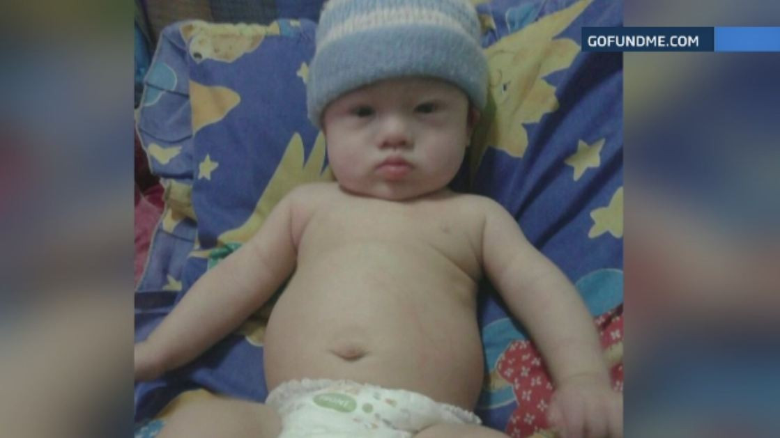 Bebelus abandonat pentru ca avea sindromul Down. Cazul a impresionat o lume: australienii au strans 150.000 dolari intr-o zi