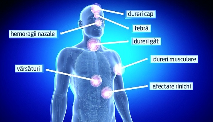 Nu exista riscuri, dar e nevoie de vigilenta. Cat de pregatita este Romania in cazul in care virusul Ebola ar ajunge la noi