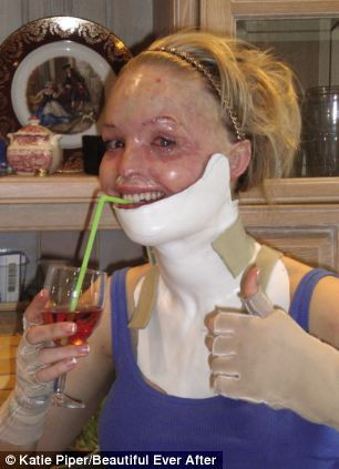 Povestea cutremuratoare a unei tinere atacate cu acid: "Barbatii ma umileau". Cum arata acum femeia