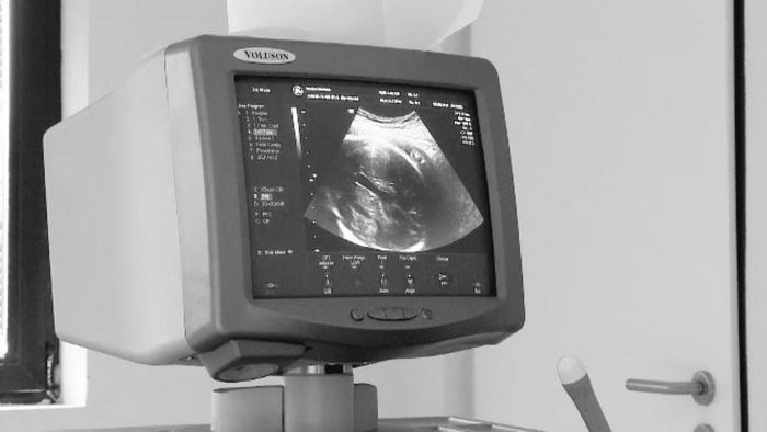 Acuzatii de malpraxis in Satu Mare. O familie da vina pe medici, dupa ce copilul pe care il asteptau s-a nascut mort