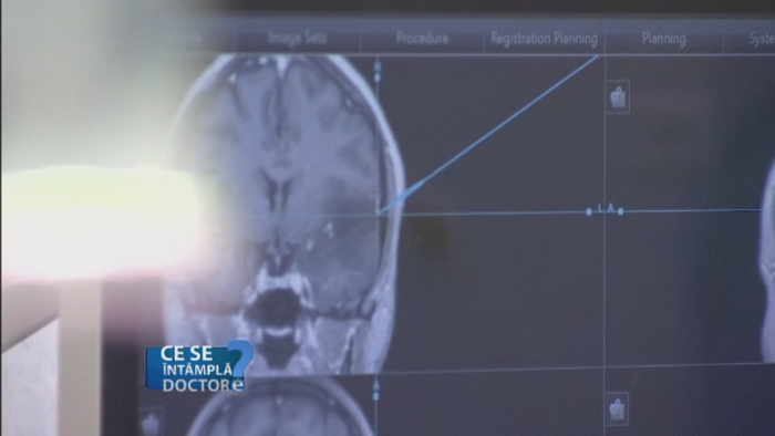 Psiholog sau psihiatru? Care este cea mai buna solutie in cazul unei depresii puternice