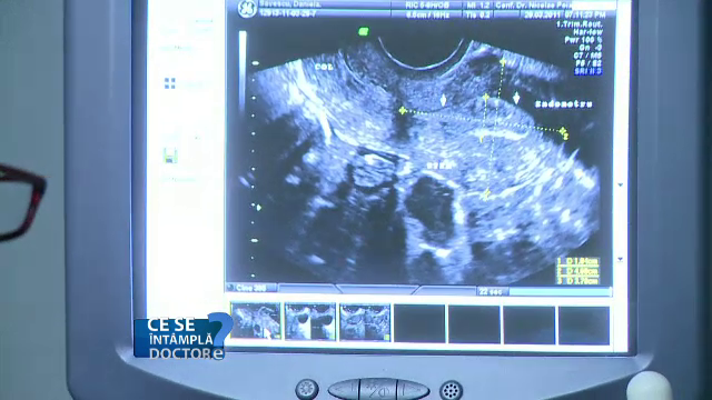 Infectiile care impiedica o sarcina. Simptomele care trebuie sa va trimita la medic impreuna cu partenerul