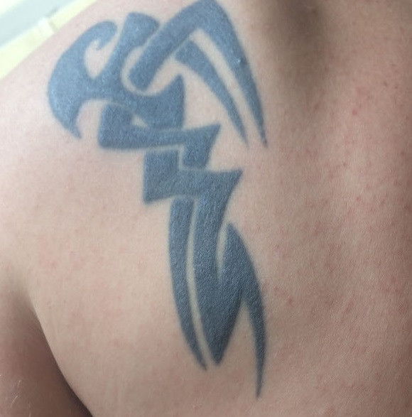 Modul inedit prin care un tanar si-a "corectat" un tatuaj facut in adolescenta. FOTO