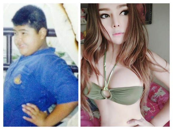 Baiat supraponderal transformat in fata superba de operatii estetice. Cazul despre care vorbesc acum milioane de tineri VIDEO