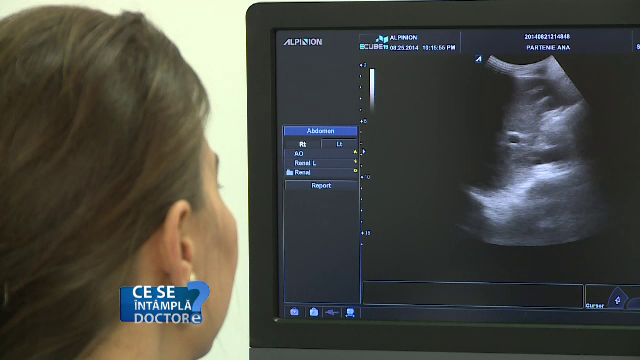 Mergeti la medic daca durerile menstruale nu cedeaza la antiinflamatoare. Afectiunea grava care poate duce la infertilitate