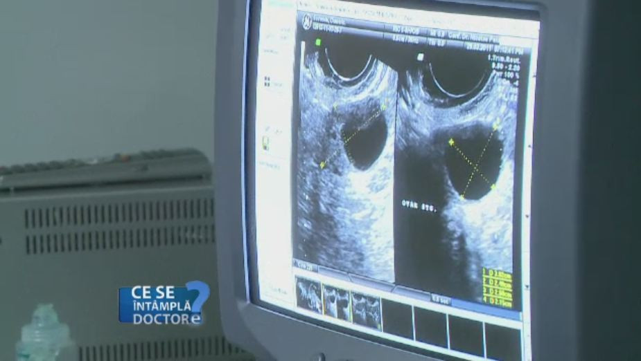 Durerile din prima zi de menstruatie sunt un semn BUN. Ce spun acestea despre sanatatea femeilor