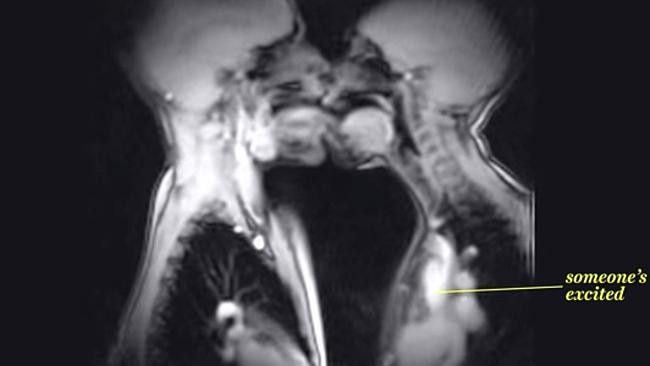 Momente de intimitate intre un barbat si o femeie, surprinse la un RMN. Ce au vrut medicii sa vada. VIDEO