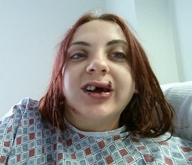 O seara in oras cu prietenii a lasat-o fara dinti. Tanara a fost impuscata in obraz, intr-un club de noapte din SUA