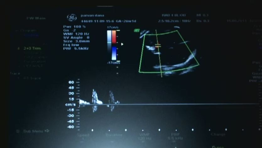 Imaginea aparuta la ecograf a ajuns viral pe internet. Marturia emotionanta a mamei. FOTO