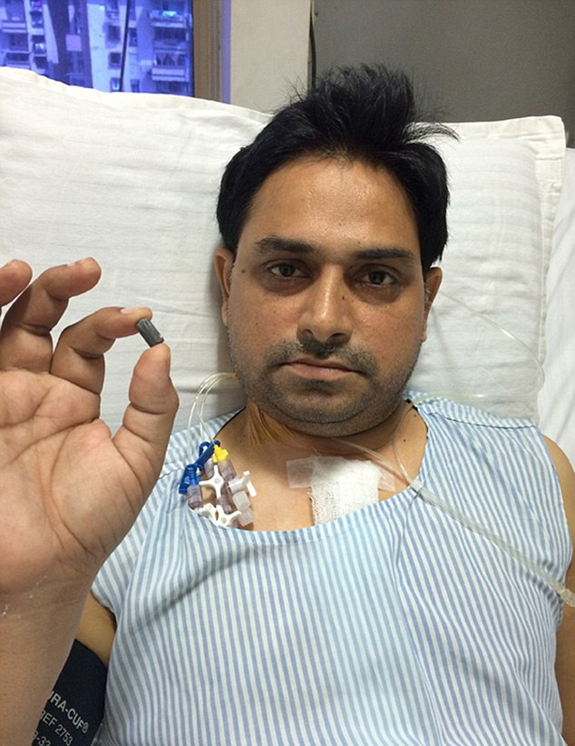 Un barbat impuscat in timpul unui jaf a trait doua luni cu un glont in inima