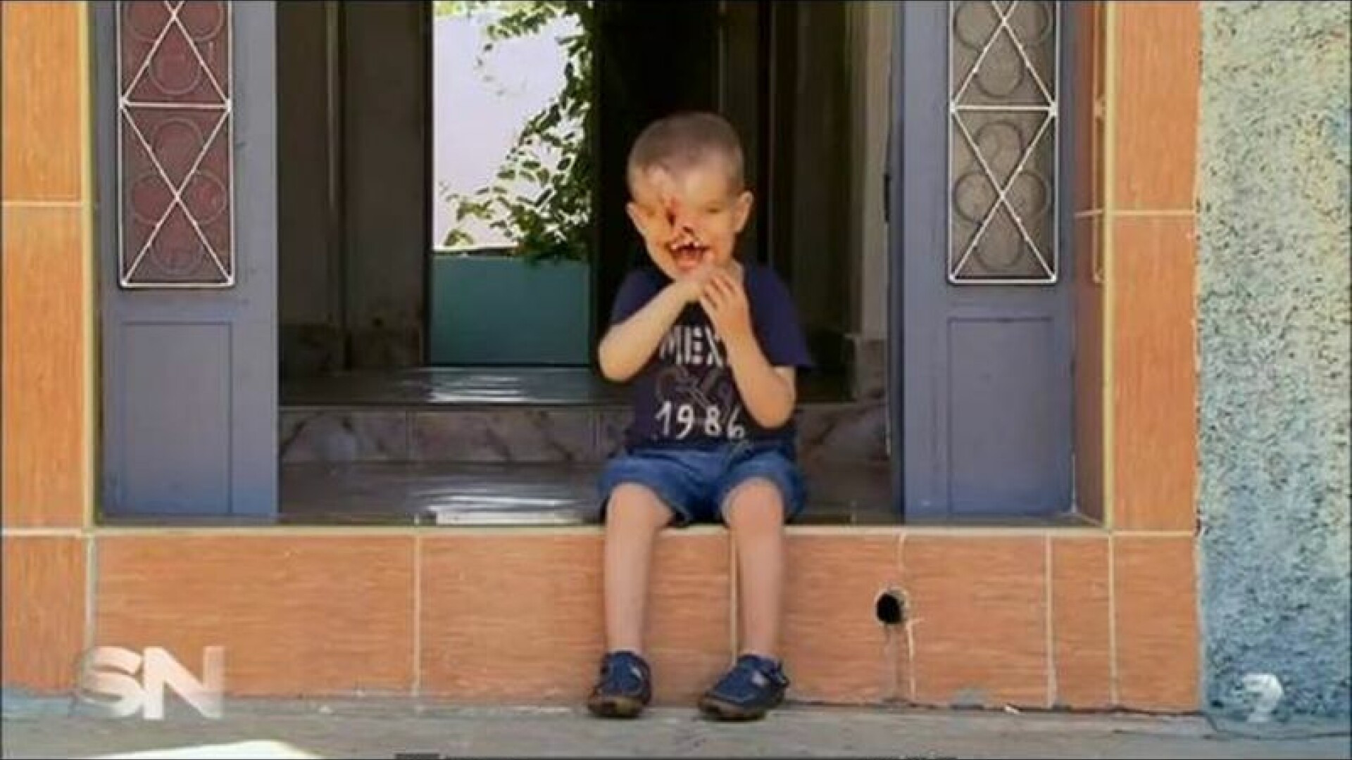 S-a nascut fara ochi, nas si gura, dar i s-a oferit sansa la o viata normala. Operatia, in schimb, are un grad mare de risc