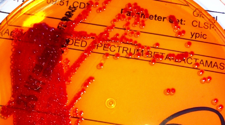 Solutie dezinfectanta plina de BACTERII intr-un spital din Capitala. Doi pacienti, infectati, cu risc de soc septic