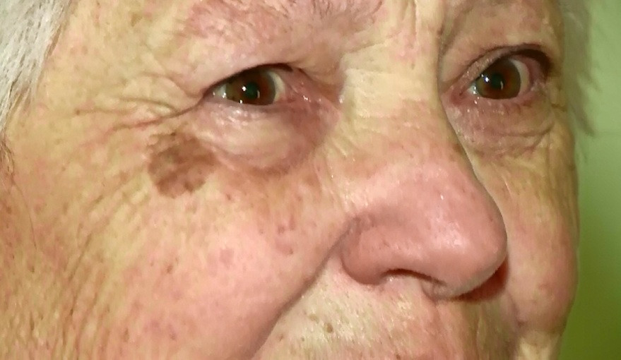 Ingrijire la domiciliu pentru batranii din Jimbolia. Au aparut deja liste de asteptare cu pensionari care au nevoie de ajutor