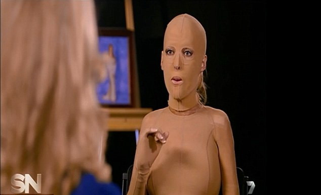 "N-am crezut niciodata ca voi arata ca inainte". Femeia care a purtat o masca timp de doi ani si-a vazut in premiera chipul