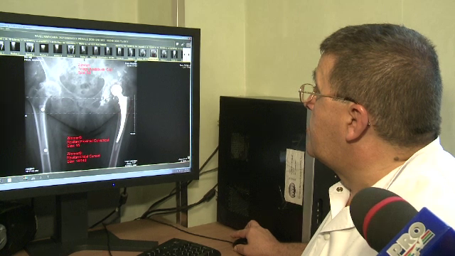 Investitia ce va curma suferinta celor cu proteze si fracturi grave. Ce fac aparatele aduse la un spital din Capitala