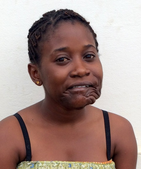 Transformarea unei adolescente din Congo, operata de o tumoare, de marimea unei mingi de fotbal, care i-a crescut pe fata