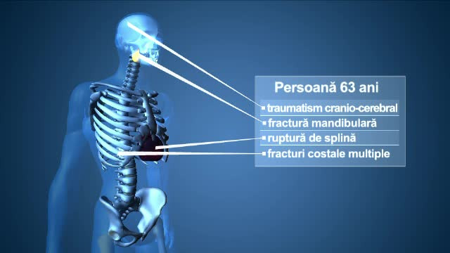 Doi dintre cei cinci politisti cercetati pentru tortura, retinuti. Acestia ar fi snopit in bataie un barbat chiar in sectie