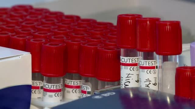 Streinu Cercel: Peste 12.700 de pacienti cu HIV/SIDA, 550 fiind cazuri noi; se estimeaza o crestere