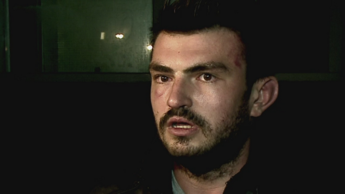 Doi tineri din Constanta, atacati de niste presupusi traficanti de droguri. MARTURIA celor doua victime