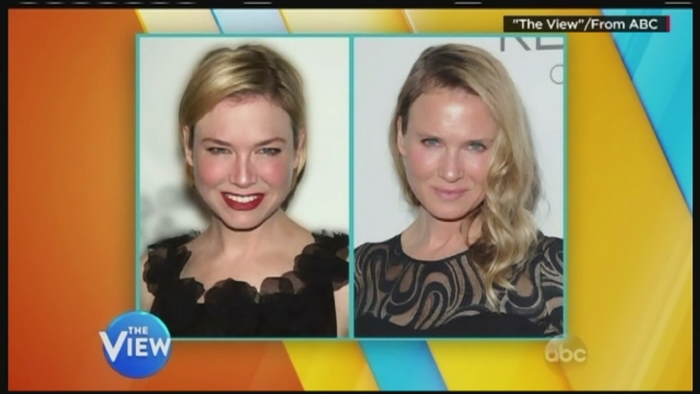 Controversele continua in cazul noii infatisari a lui Renee Zellwegger. Ce spun admiratorii despre actrita