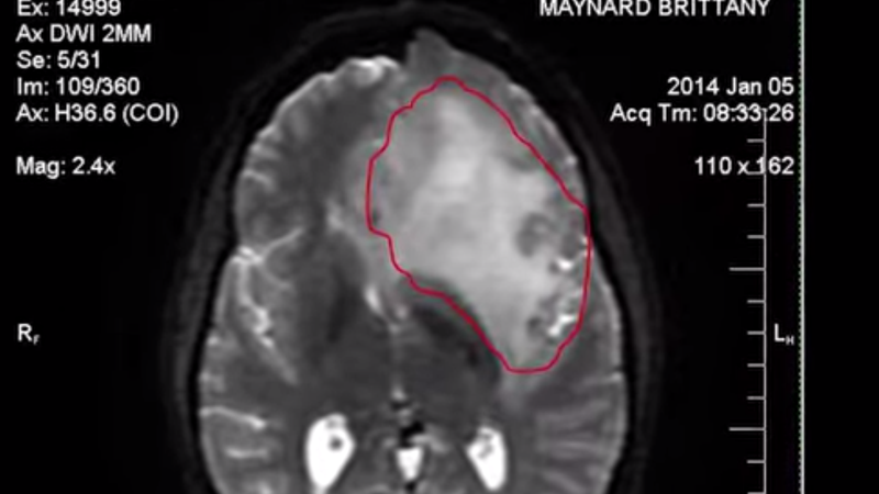 Care a fost ultima dorinta a unei femei bolnave de cancer la creier inainte de-a se sinucide asistat