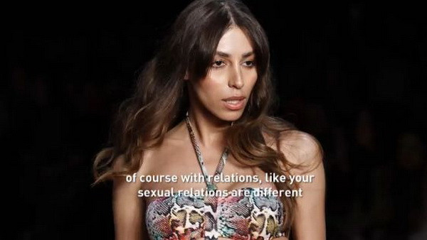 Este una dintre cele mai solicitate supermodele, insa chipul ei ascunde un tragic secret. Povestea ei e lectia tolerantei