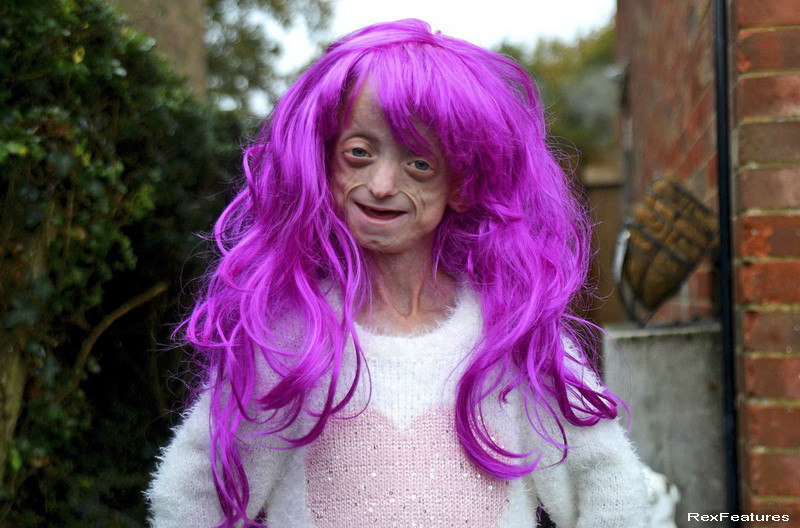 Sufera de o boala grava, in stadiu terminal, insa profesorii au obligat-o sa isi dea jos peruca. "Este dezgustator". FOTO