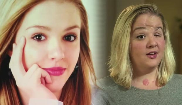 Cosmarul unei victime a SMS-urilor la volan. O tanara din SUA le da sfaturi adolescentilor dupa un accident ingrozitor