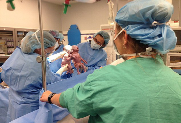 S-au nascut tinandu-se de mana si nu s-au despartit nici dupa 6 luni de viata. Povestea unica a unor fetite gemene