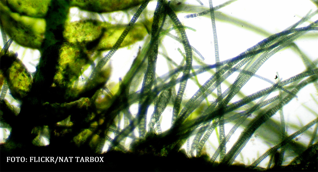 Savantii au descoperit un virus care ne reduce inteligenta. Locurile din Romania unde riscati sa va infectati