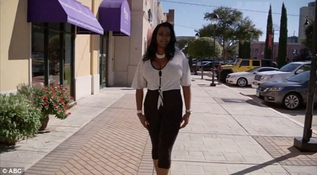 Sanii acestei femei cantareau o treime din greutatea corpului sau. Cum arata inainte de operatie