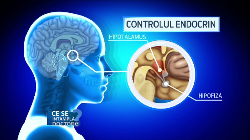 Cand se impune o programare la neurolog. Si persoanele foarte tinere pot fi afectate de o tumora benigna