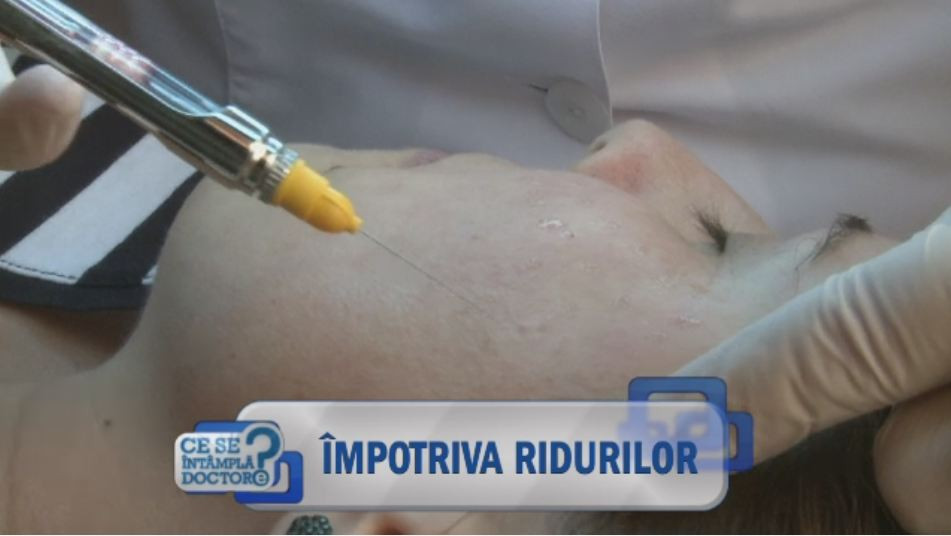 Primele riduri pot sa apara inca din adolescenta. Pasi importanti de luat in lupta anti-ageing: cum ne ajuta cititul