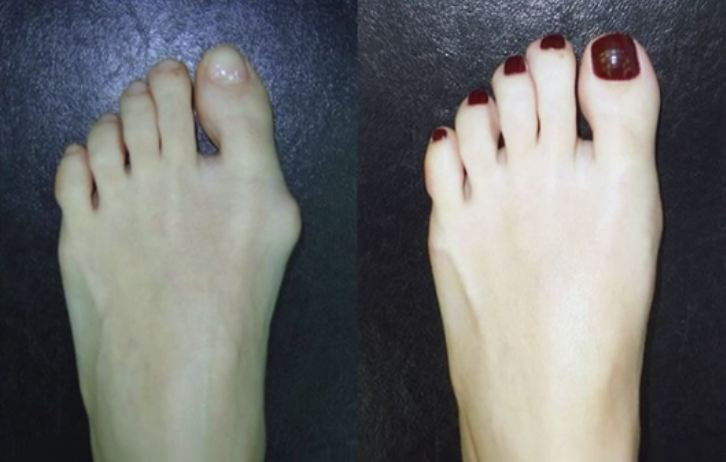 Cu cat se mai vand iluziile in Romania. Ancheta internationala in cazul "vindecarii miraculoase" care a pacalit mii de romani