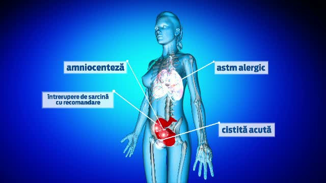 Ce afectiuni va puteti trata gratuit la spitalele private. Clinicile au adoptat programul "Internarea de o zi"