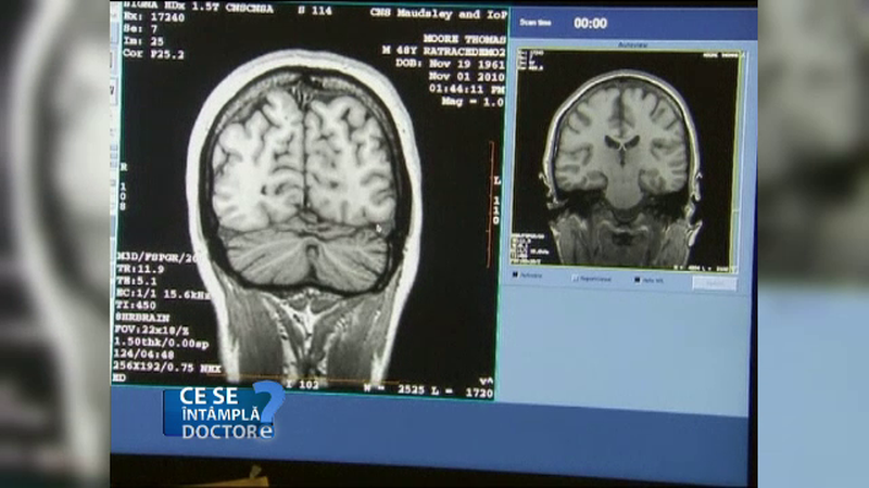 Efectul nebanuit al antiinflamatoarelor asupra sanatatii. Sfatul specialistilor: nu le luati la intamplare