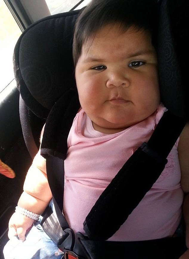 Fetita care la zece luni arata ca la cinci ani. Boala de care sufera afecteaza doar 15.000 de persoane