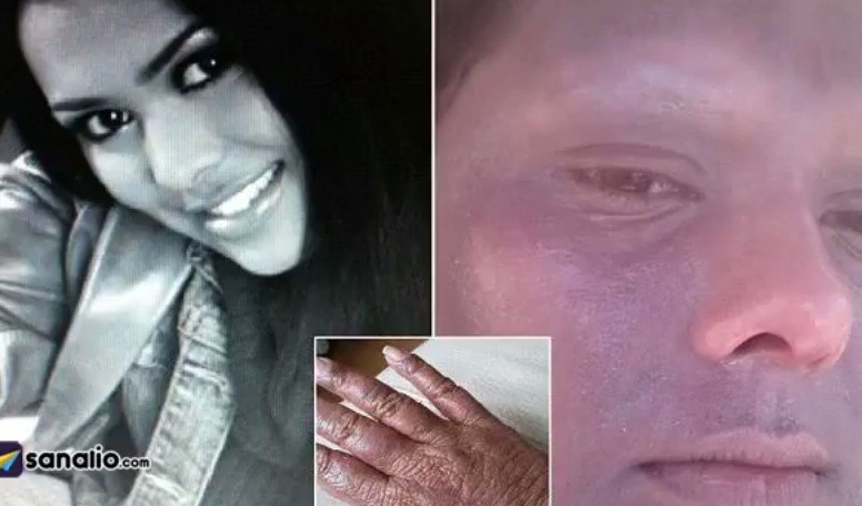 Cum arata femeia care de 20 de ani nu a mai iesit din casa din cauza unei boli pe care medicii nu o pot diagnostica. VIDEO