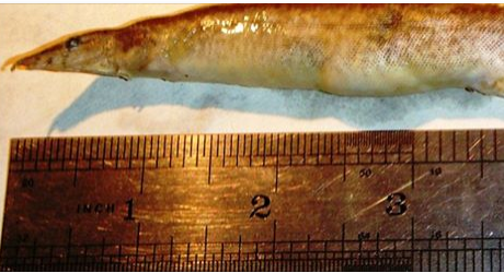 Un adolescent a ajuns la spital cu un peste de 15 centimetri infipt in gat. Cum s-a intamplat totul