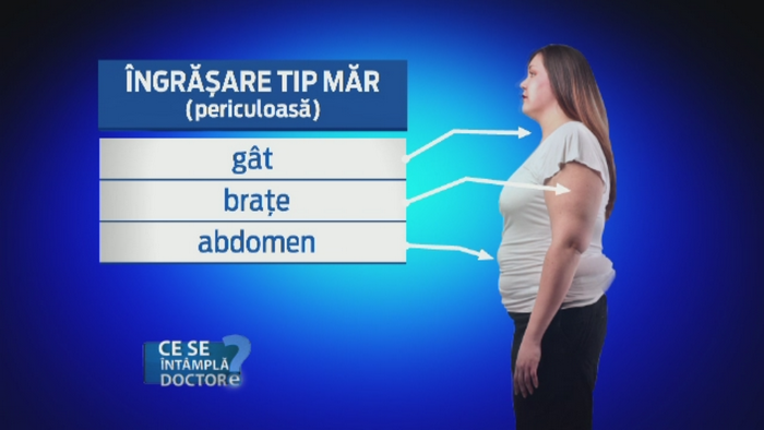Cele doua moduri de ingrasare. Ce inseamna obezitatea in forma de para si de ce este periculoasa cea in forma de mar
