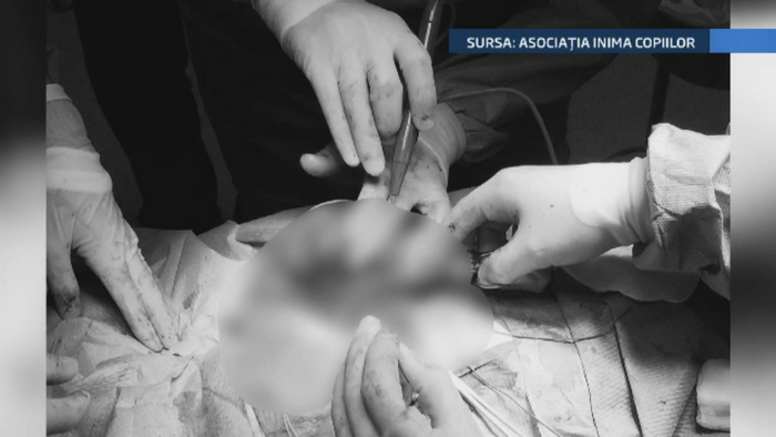 Operatie in premiera in Romania. Medicii de la Marie Curie i-au extirpat unei fetite de doua luni o tumoare de 1 kilogram