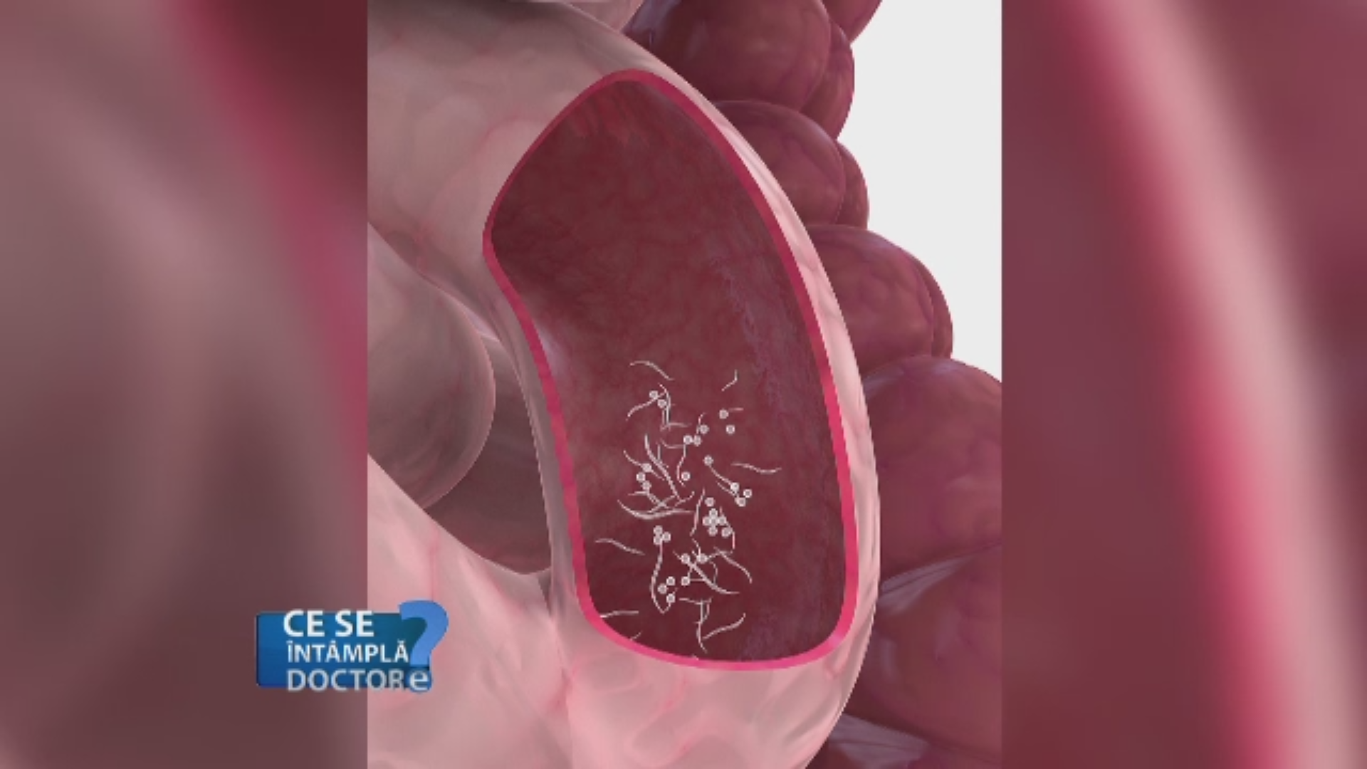 Sfaturi pentru prevenirea parazitilor intestinali la copii. Cat de usor se pot ascunde aceste probleme